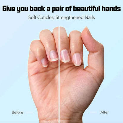 3 Days Nail Care⚡Get 50% OFF + Free Shipping — While It Lasts