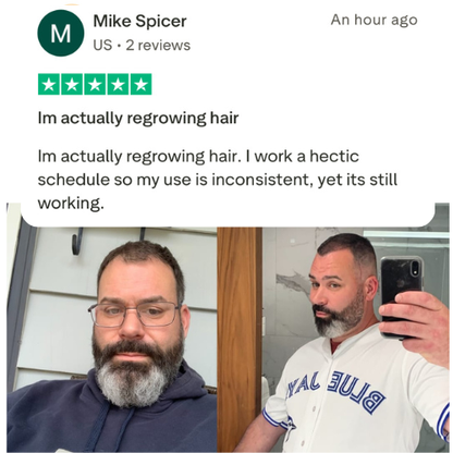 Science Backed Hair Regrowth Serum Without Side Effects
