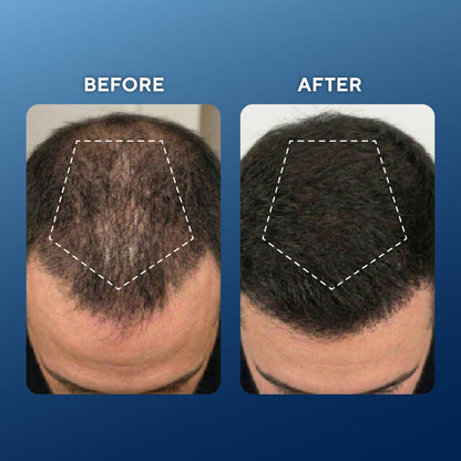 Advanced Copper Peptide Hair Regrowth Formula