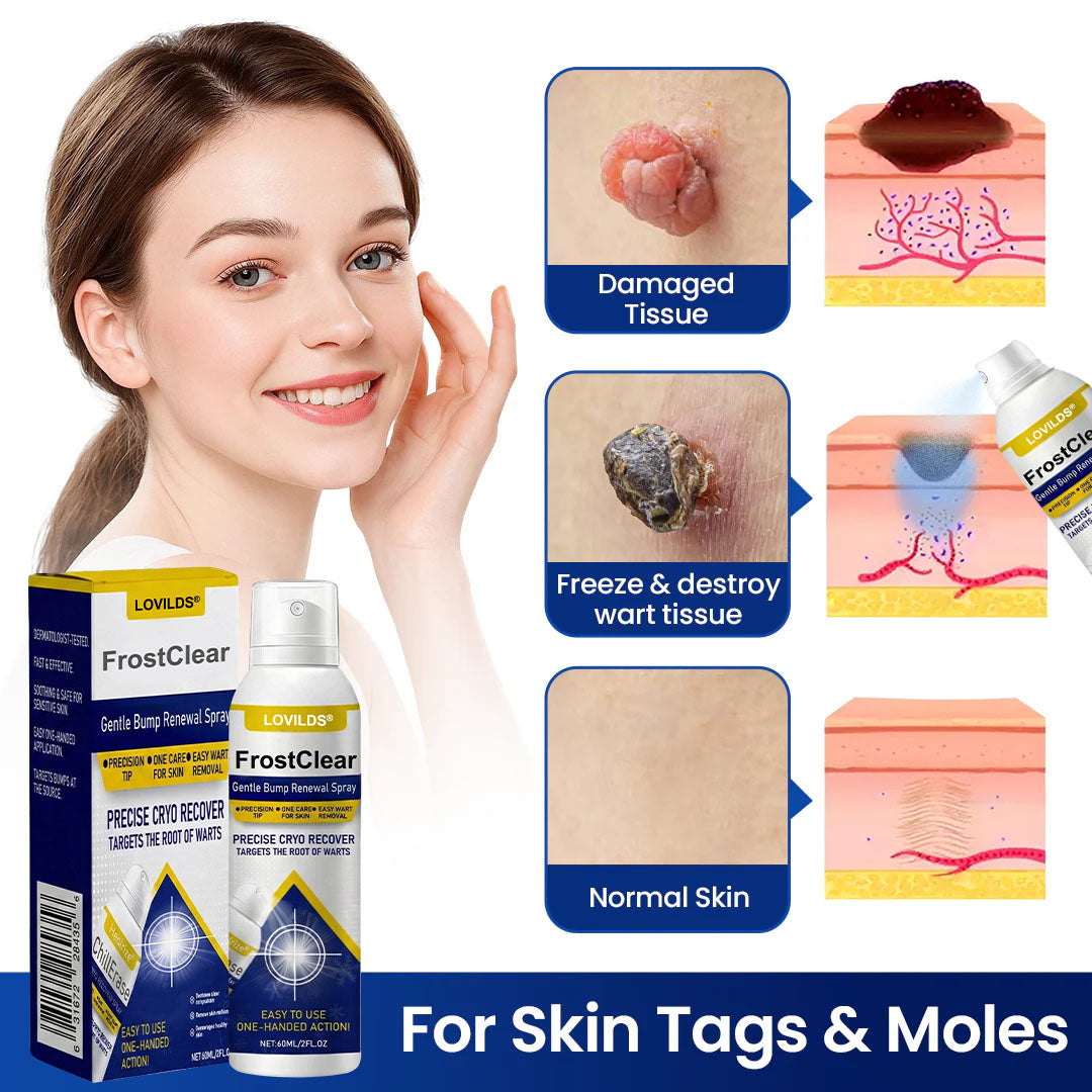 LOVILDS®FrostClear Gentle Bump Renewal Spray