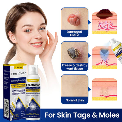 LOVILDS®FrostClear Gentle Bump Renewal Spray