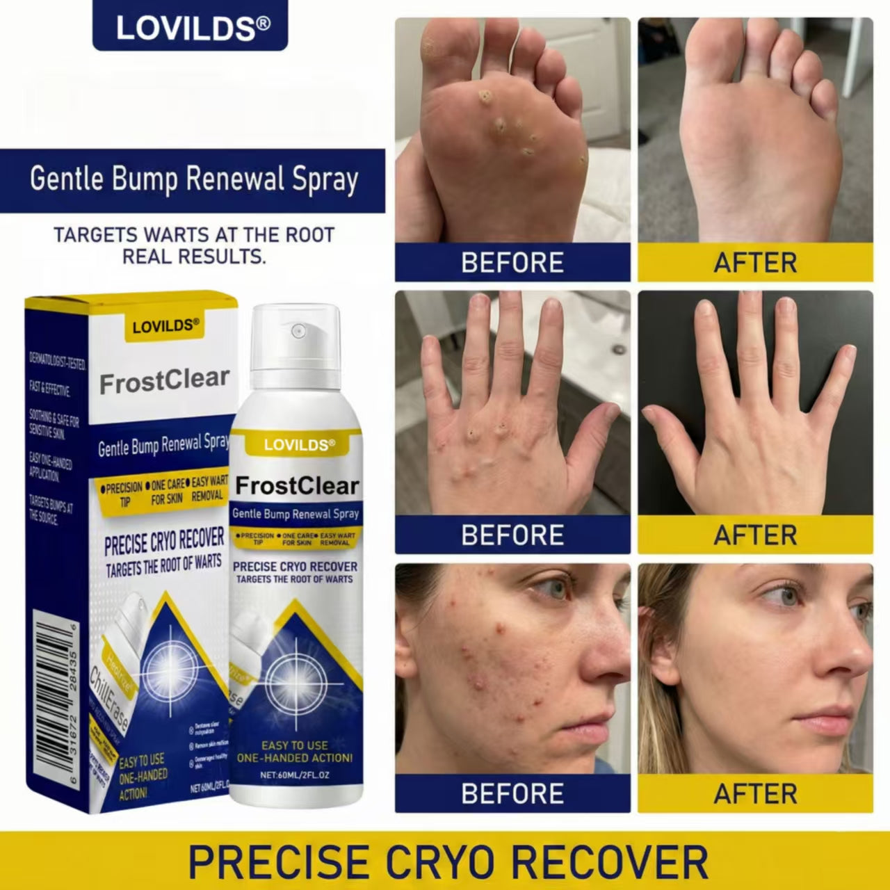 LOVILDS®FrostClear Gentle Bump Renewal Spray