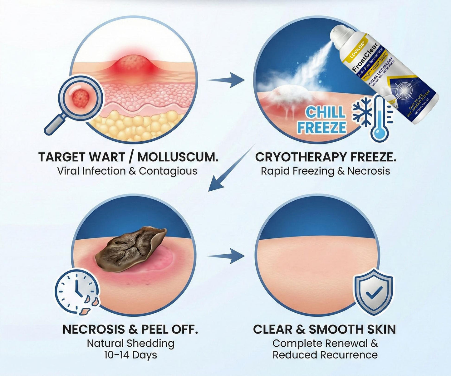 LOVILDS®FrostClear Gentle Bump Renewal Spray