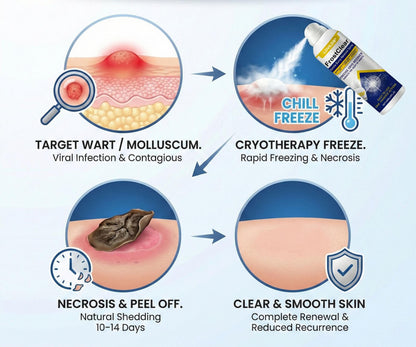 LOVILDS®FrostClear Gentle Bump Renewal Spray
