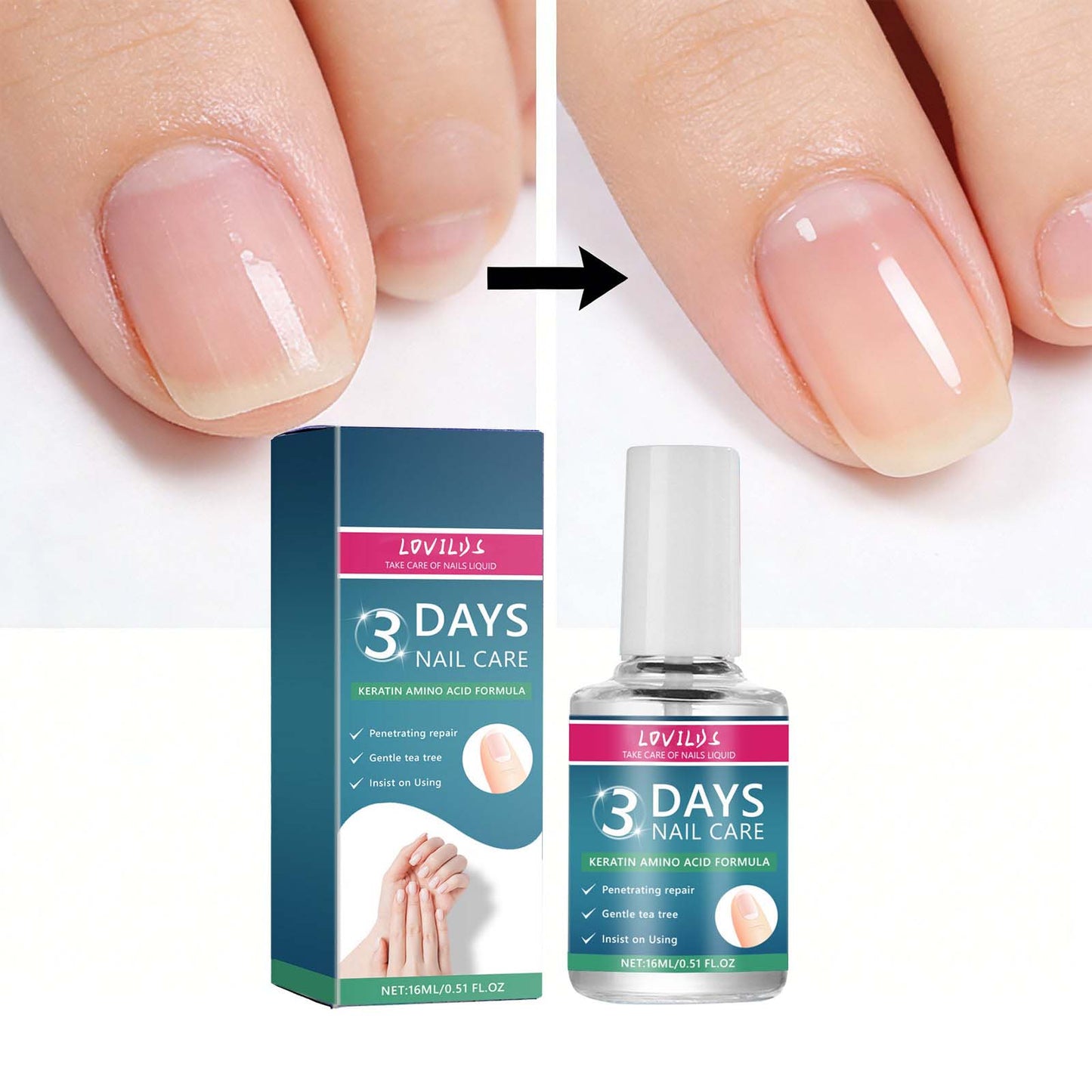 3 Days Nail Care⚡Get 50% OFF + Free Shipping — While It Lasts