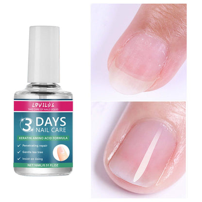 3 Days Nail Care⚡Get 50% OFF + Free Shipping — While It Lasts