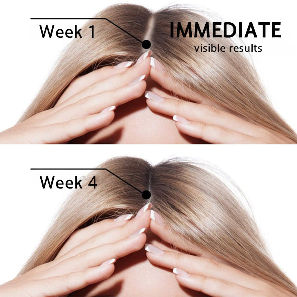 ✅👨‍⚕️ Official Store🔥LOVILDS® Highly Effective Biotin & Rosemary Hair Growth Serum — Visibly fills thinning areas & receding hairlines (🔥 Limited-Time Offer, ⏳ Last 30 Minutes)