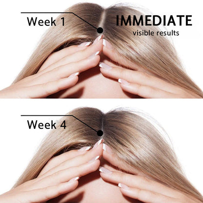 ✅👨‍⚕️ Official Store🔥LOVILDS® Highly Effective Biotin & Rosemary Hair Growth Serum — Visibly fills thinning areas & receding hairlines (🔥 Limited-Time Offer, ⏳ Last 30 Minutes)