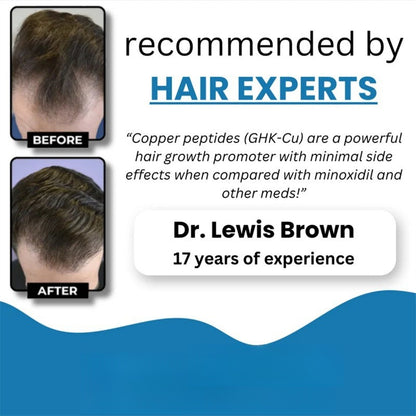 Science Backed Hair Regrowth Serum Without Side Effects